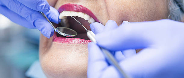 Best Emergency Dental Care for Broken or Chipped Teeth in Rhome, TX